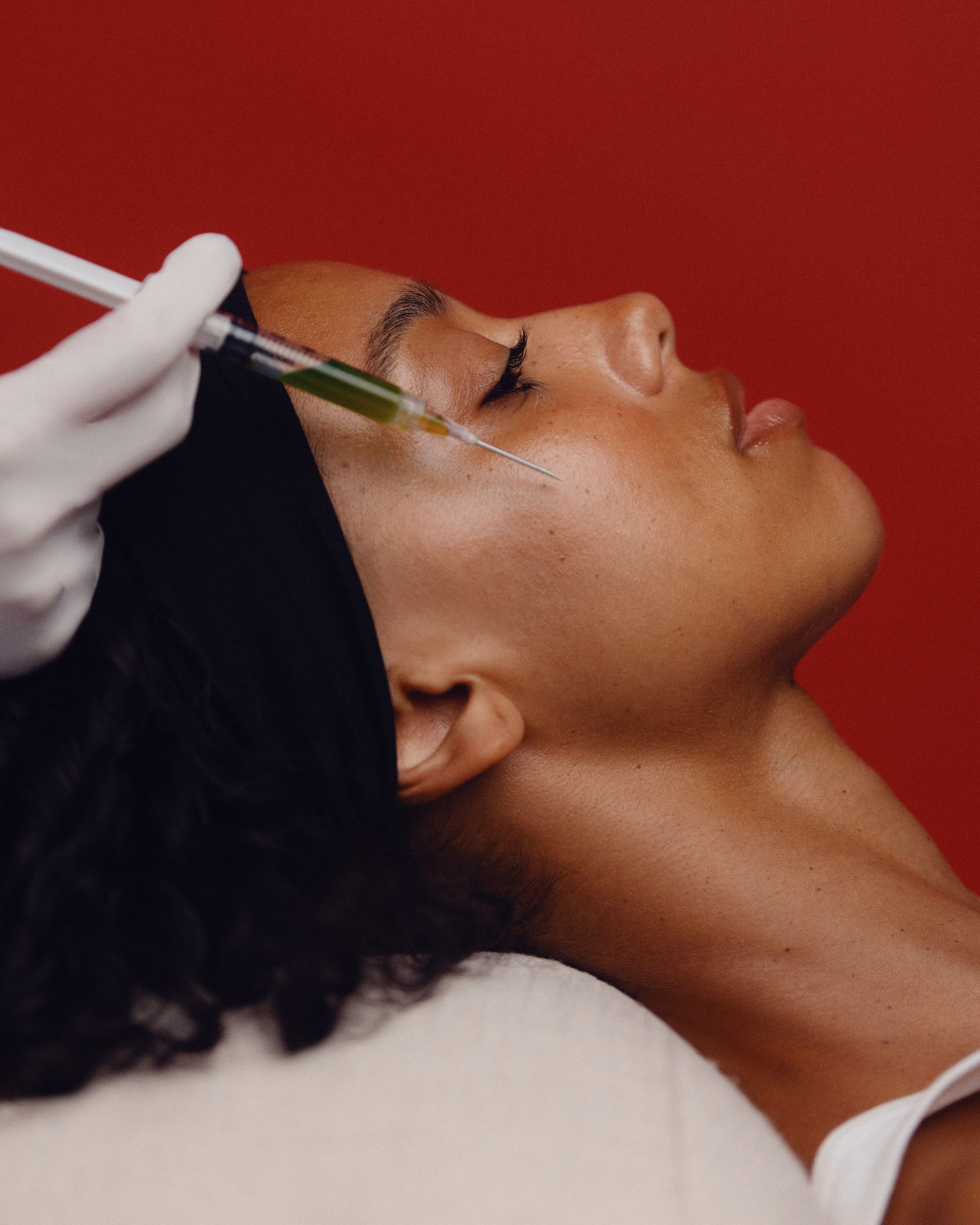 Microneedling
