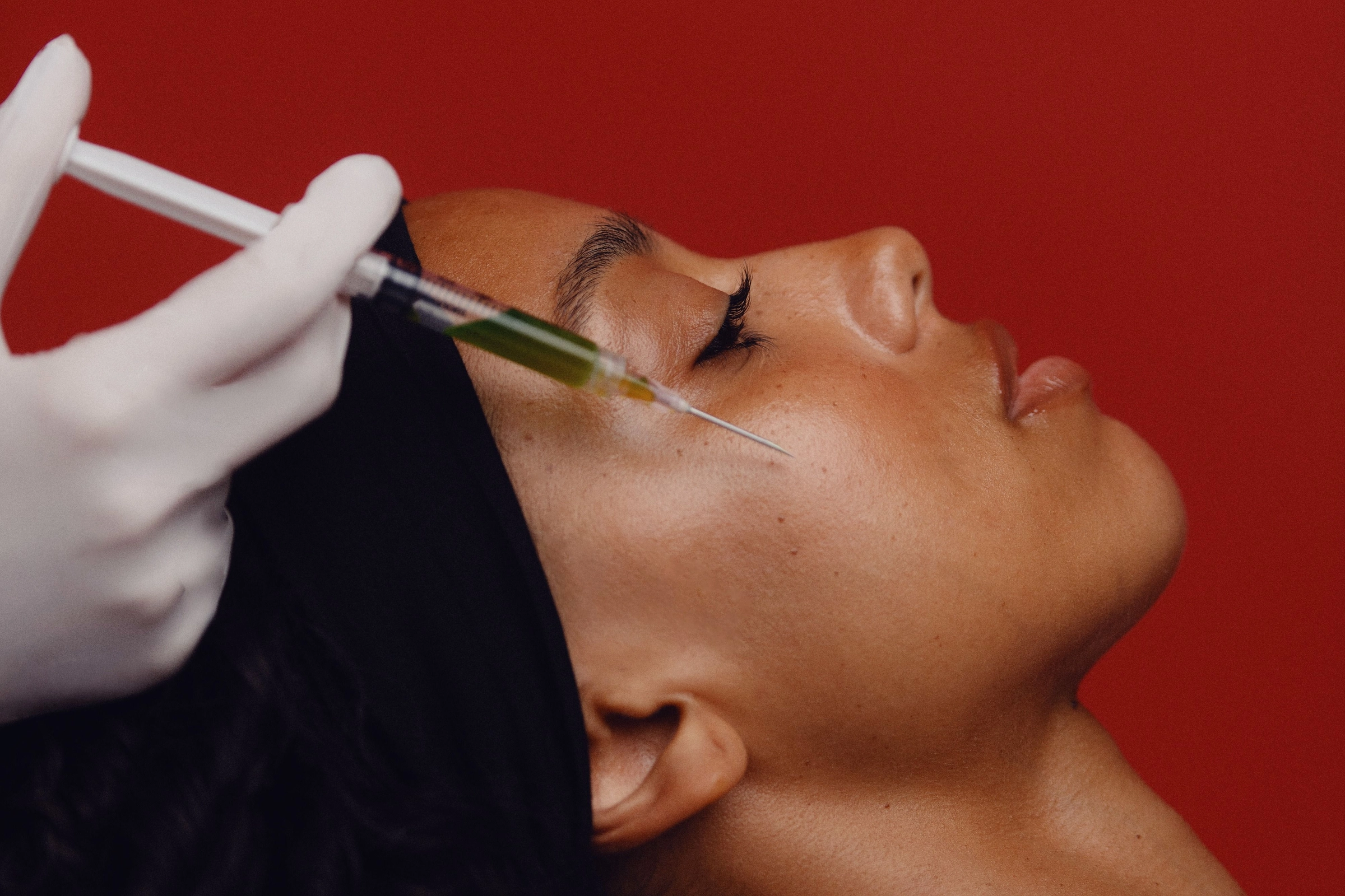 Wrinkle relaxer treatment in progress
